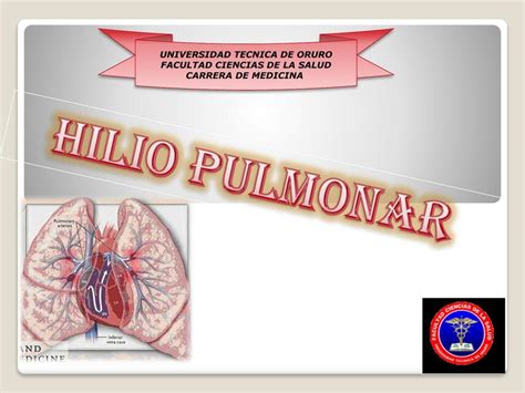 Hilio Pulmonar Javier Veizaga Udocz