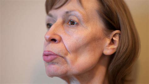 Blefaroplastia Y El Lifting Transforma Tu Rostro Con Estas Operaciones