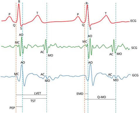 Sensors Free Full Text Heart Rate Variability Analysis On