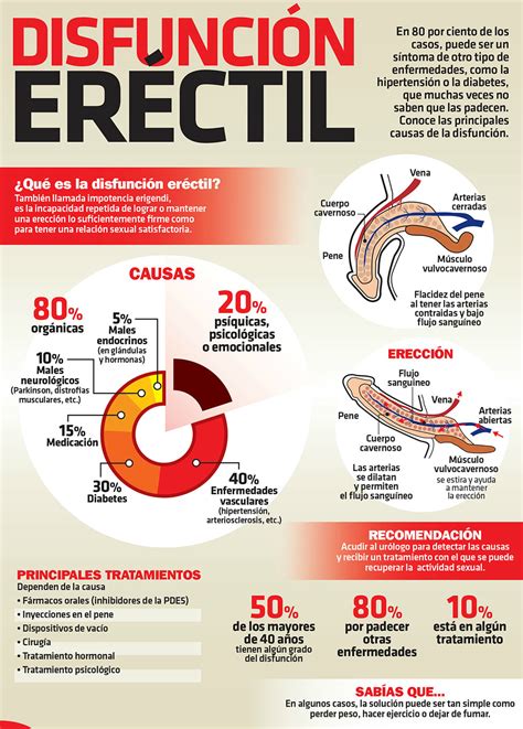 La disfunción eréctil y sus causas Centro Especializado en Urología