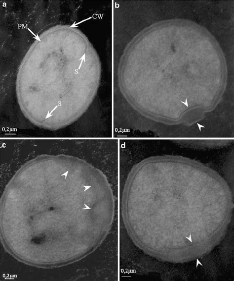 Transmission electron micrographies of S. aureus cells stained with ...