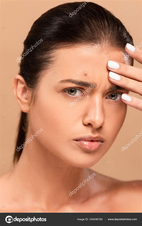 Naked Woman Pimple Face Touching Forehead Isolated Beige Stock Photo By IgorVetushko 334246182