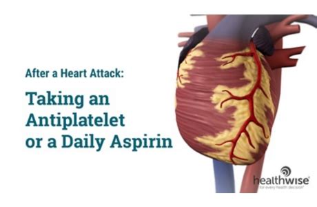 After a Heart Attack: Taking an Aspirin or Antiplatelet Video & Image