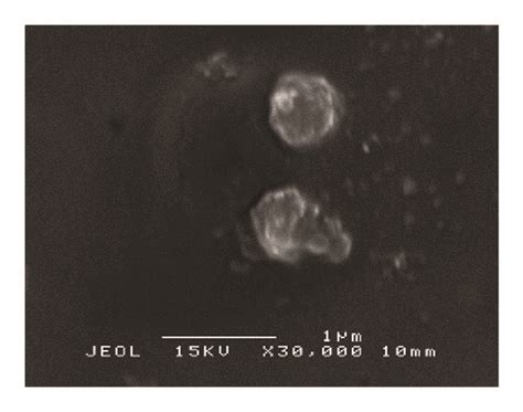 (a) Scanning electron micrograph of untreated S. aureus. (b) Scanning ...