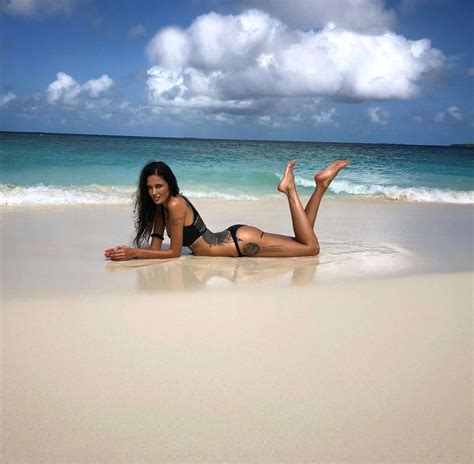 WAG Shows Off Her Gruesome Sagging Bum Implants - Influencer News