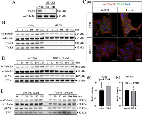 αtat1 Induced Tubulin Acetylation Promotes Ameloblastoma Migration And