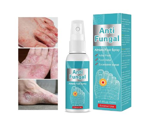 Natural Athlete's Foot Treatment Spray for Feet Itch, Sweat, Peeling
