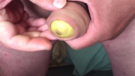 Potato In Foreskin British Gay Amateur Amateur Porn XHamster