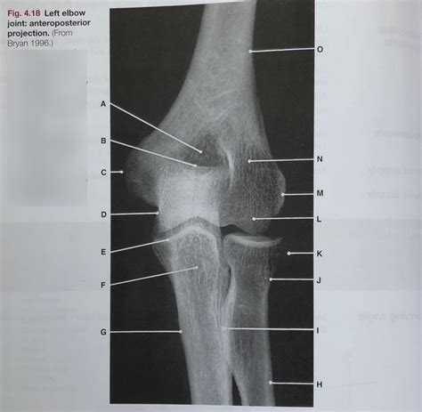 Left AP Elbow X Ray Diagram Quizlet