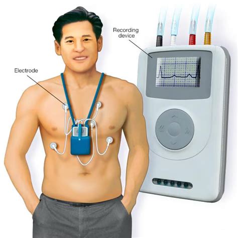 Cardiac Event Recorder - Aerospace Cardiology