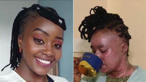 Kiambu Woman In Pain After Partner Pours Hot Water On Her Face TV47 Digital
