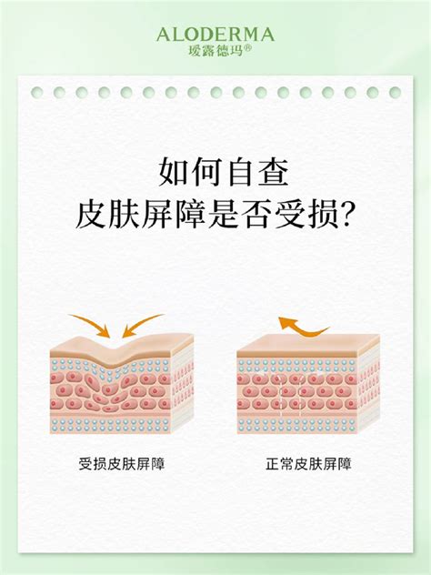 科普｜皮肤屏障受损怎么修复？ 知乎