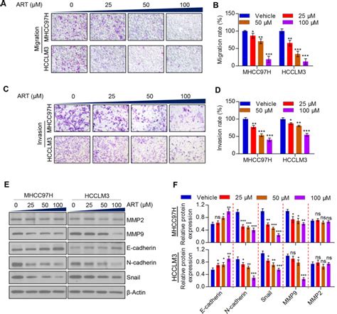 Art Suppresses Hcc Cell Migration And Invasion Through Regulating