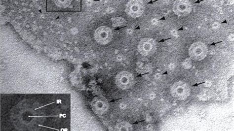 Pores On The “Platypus Of Microbiology” May Reveal How Complex Life ...
