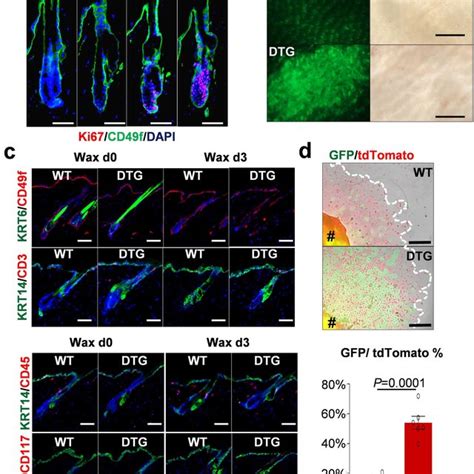 Mir 31 Up Regulation In Skin Epithelium Induces Hfsc Transepidermal