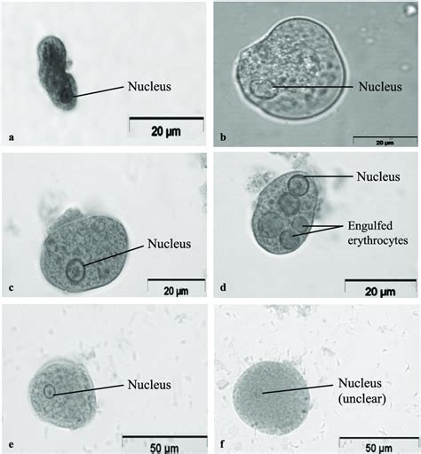 Fecal Wbc Prep With Stain