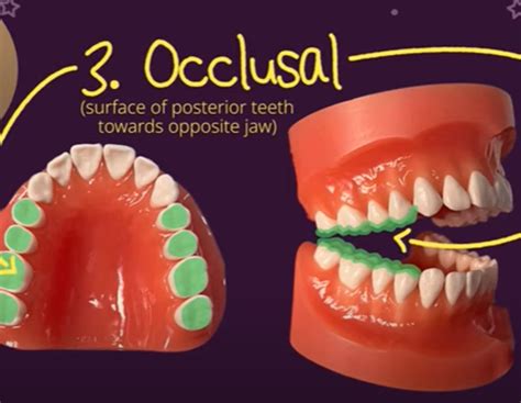 What Is Occlusal In Dentistry 1 Dentist In California 95035