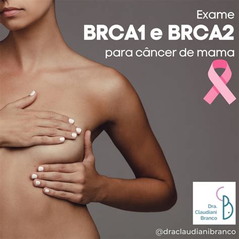 Exame BRCA1 e BRCA2 para câncer de mama Dra Claudiani Alves Branco