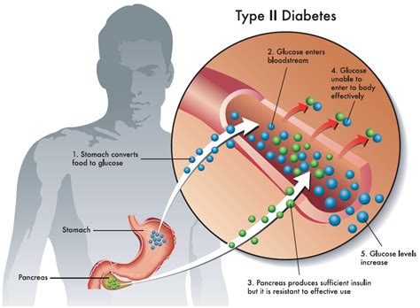 Diabetes - Lessons - Blendspace 
