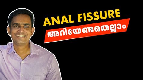 Anal Fissure അറയണടതലല YouTube