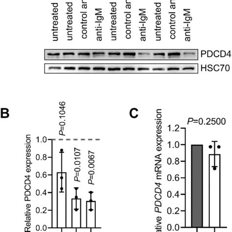 Regulation Of PDCD4 By Anti IgM In CLL Cells A B CLL Samples N 3