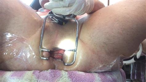 Anal Gape Gay Fisting Fisting Porn XHamster