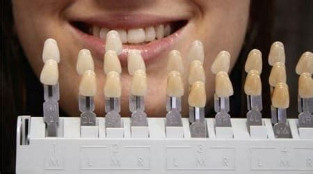 ᐉ Шкала расцветки VITA (Вита) оригинал, 1 шт., цена 4 000₴ ᐉ Купить в ...