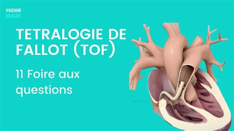 TETRALOGIE DE FALLOT TOF 11 Foire Aux Questions YouTube