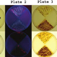 Growth and fluorescence of C. gattii and C. neoformans on m-FDTG agar ...