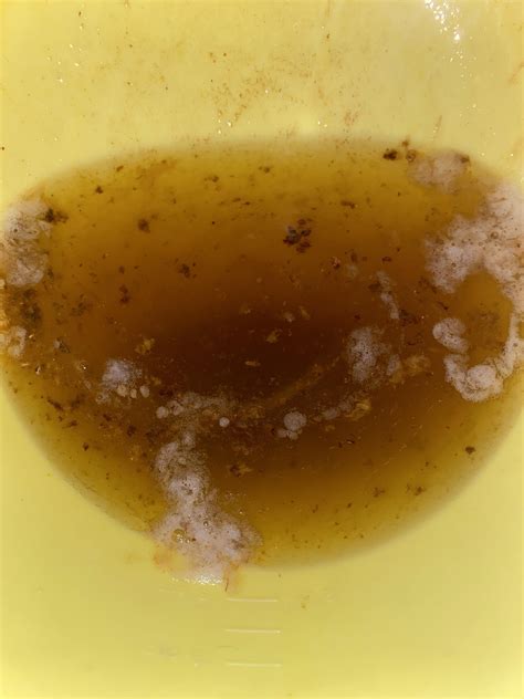What Does Normal Vomit Look Like at Tina Kirby blog