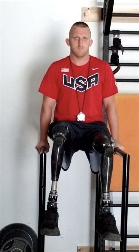 Gay Amputee Fetichism And Others