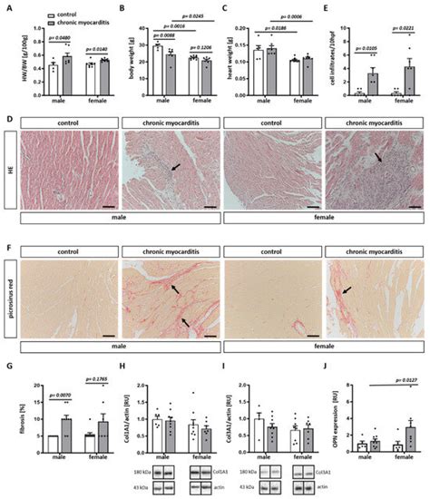 Sex Differences In Expression Of Pro Inflammatory Markers And MiRNAs In A Mouse Model Of CVB