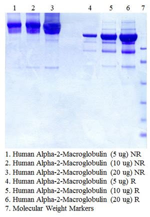 Alpha-2-Macroglobulin, Human Plasma - Molecular Innovations, Inc.