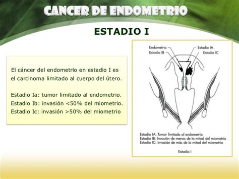 Cancer Endometrial