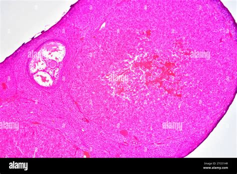 Ovary Section Showing Corpus Luteum Stroma Epithelium And Follicles