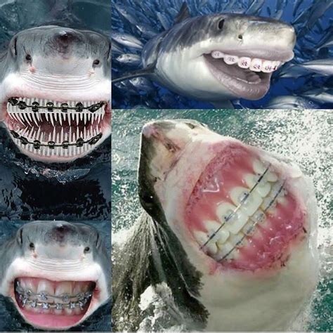 How Many Rows of Teeth Do Sharks Have - Elias-has-Ho