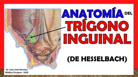 Triángulo Inguinal