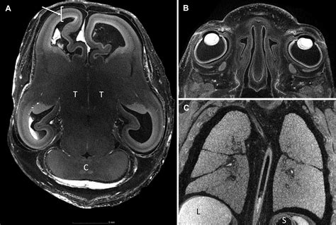 Fetal Postmortem Imaging An Overview Of Current Techniques And Future