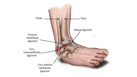 Common Foot Conditions Orpington Podiatry