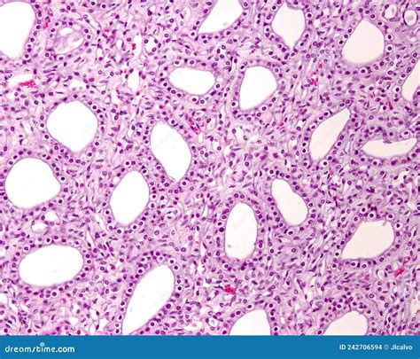 Kidney Medulla. Papillary Ducts Stock Photo | CartoonDealer.com #242706594