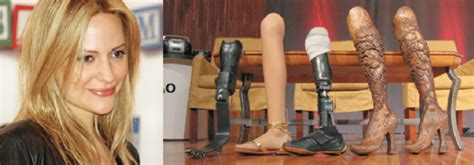 34. Aimee Mullins and a few of her remarkable prosthetic legs. | Download Scientific Diagram