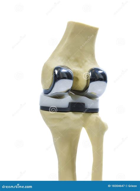 Plastic Model Of A Knee Replacement Royalty-Free Stock Photo