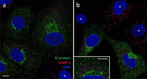 Non Overlapping Localizations Of The M Protein And LAMP 1 In