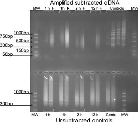 PCR Amplified Suppression Subtractive Hybridization SSH CDNAs And