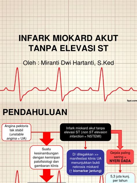 Infark Miokard Akut Tanpa Elevasi St