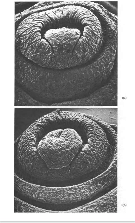 Prostomium & Peristomium | bioearthworm