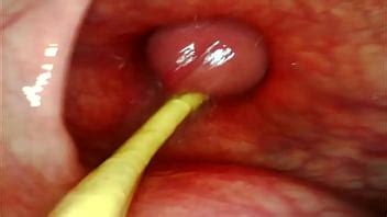 EXTREME ANAL POV CAMERA INSIDE HER ASSHOLE AS I POUND HER WITH MY BIG COCK AND CUM DEEP INSIDE