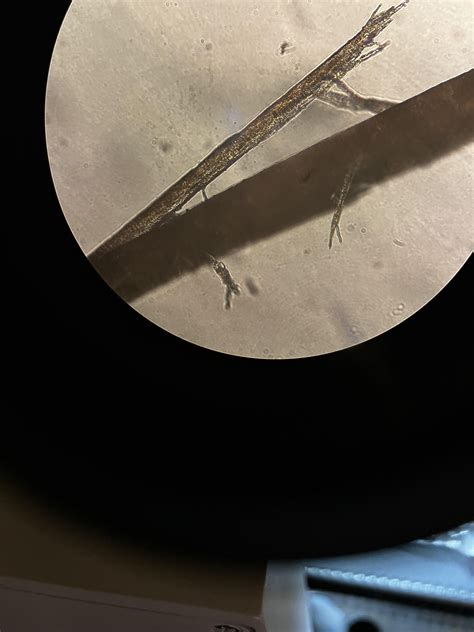 What Do Split Ends Look Like Under A Microscope