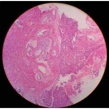 Photomicrograph At X Revealing Odontogenic Epithelium And Connective