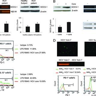 SOCS 1 Negatively Regulates PD 1 And IL 12 Expression In THP 1 Cells